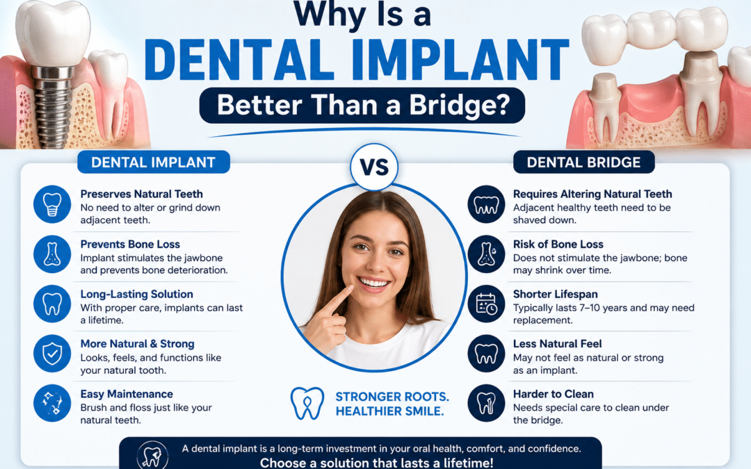 Why Is a Dental Implant Better Than a Bridge?